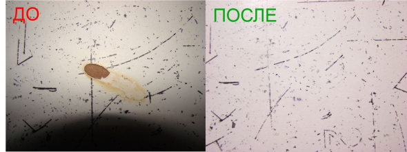استعادة جزئية للحرق