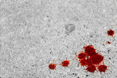 بقع الدم تحتاج إلى غسلها طازجة.