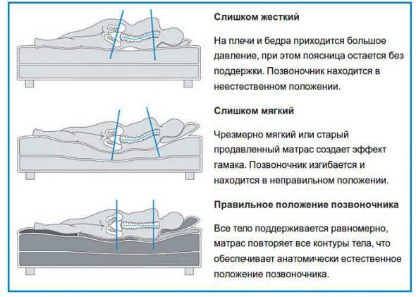 مستويات صلابة فراش